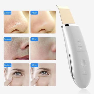 ClearGenie™ Ultrasonic Skin Scrubber